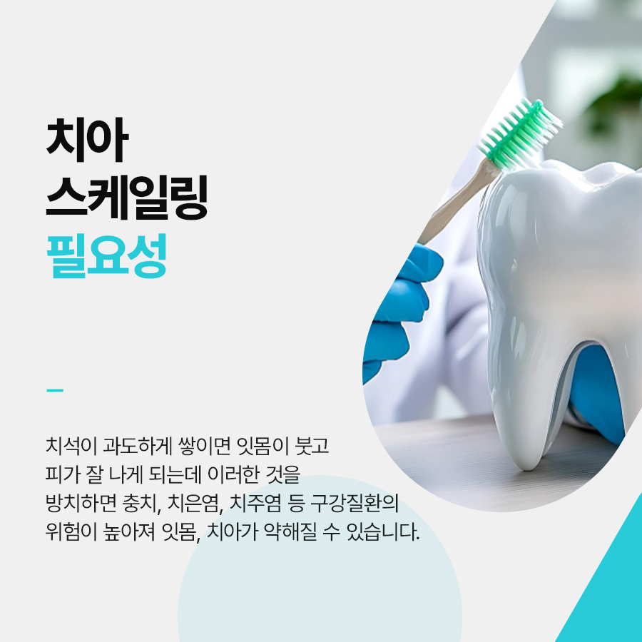 강남클리어치과 스케일링 아픈가요 걱정이라면 관련 이미지 3