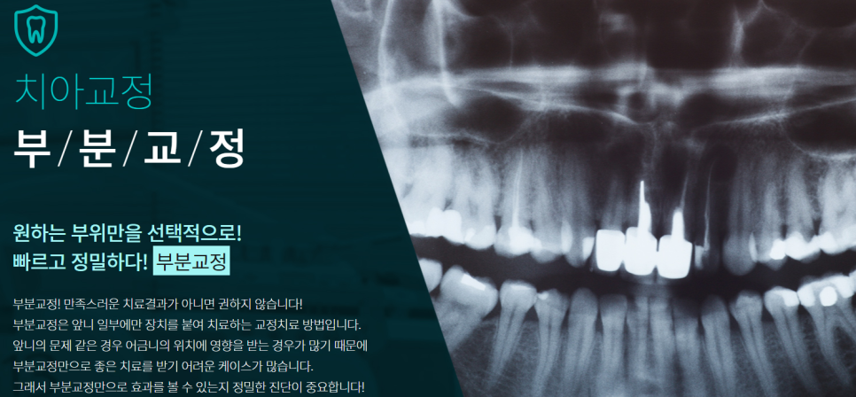 서초동치아교정 구강상태를 먼저 파악하고 관련 이미지 6