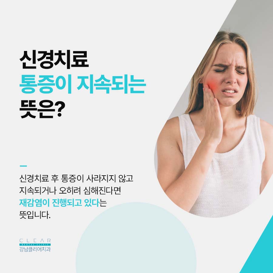 치아 신경치료 통증이 계속 남는다구요? 관련 이미지 3