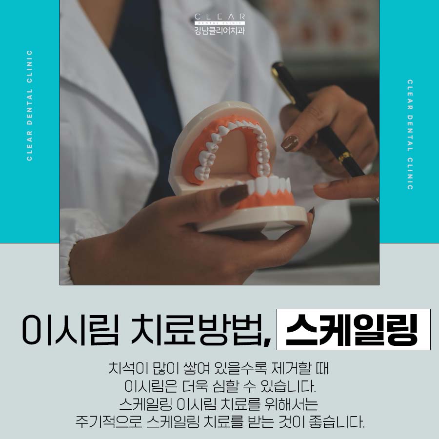 스케일링 이시림 증상 원인 및 치료방법 관련 이미지 4
