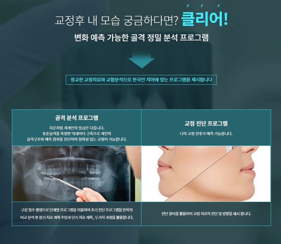 교정전 발치 상황에 따라서 관련 이미지 7