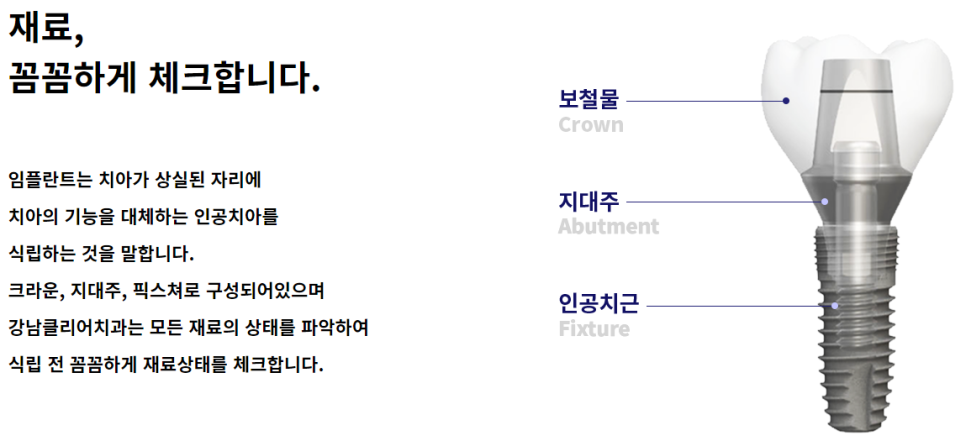 강남임플란트치과 잇몸뼈 건강까지 생각한다면 관련 이미지 8