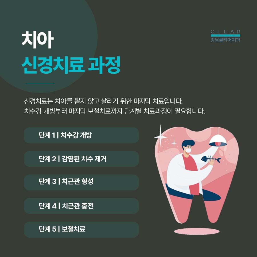 강남 신경치료 과정 기간 주의사항까지 꼼꼼하게 관련 이미지 2