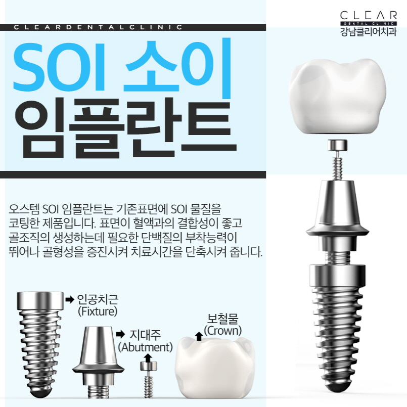 오스템임플란트 SOI임플란트 무엇이 다를까요? 관련 이미지 2