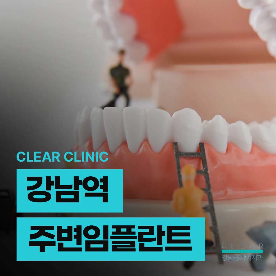 강남역 주변 임플란트 잘하는곳 이건 체크해봐야 관련 이미지 1
