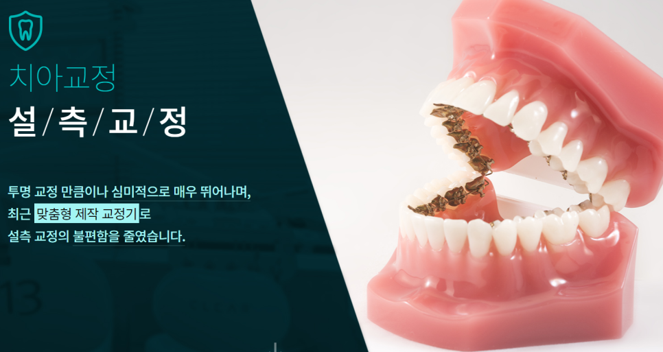 강남클리어치과 심미성과 기능성을 모두 만족 관련 이미지 3
