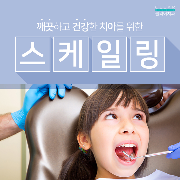 자연치아를 소중히 하기 위한, 스케일링 관련 이미지 1