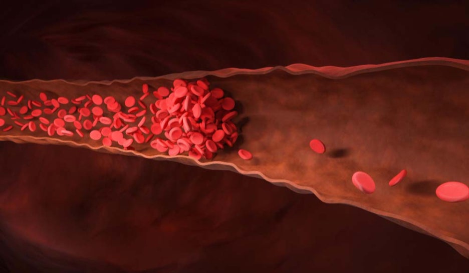 콜레스테롤 ldl hdl 정상수치 낮추는 음식 추천 관련 이미지 5