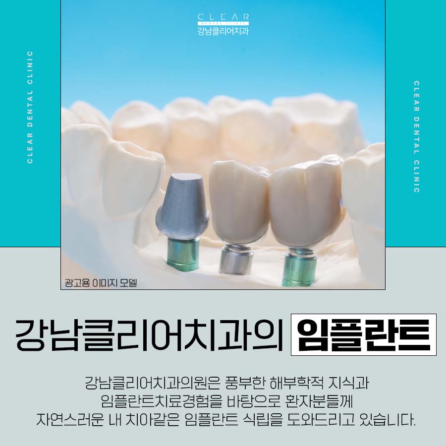 서초역 임플란트 부작용을 피하려면 관련 이미지 4