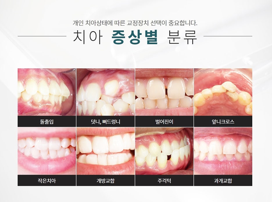 강남역 11번출구 치과 찾아보고 있다면? 관련 이미지 6