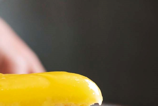 신경치료 후 크라운 꼭 해야되는 이유 관련 이미지 22