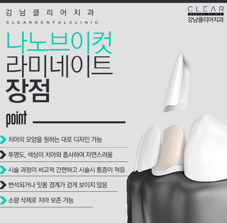 강남라미네이트 앞뒤옆까지 확실하게하자! 관련 이미지 3