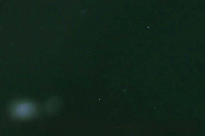 역삼동 임플란트 치과 유지기간 오래 쓰려면 주의사항 관련 이미지 17