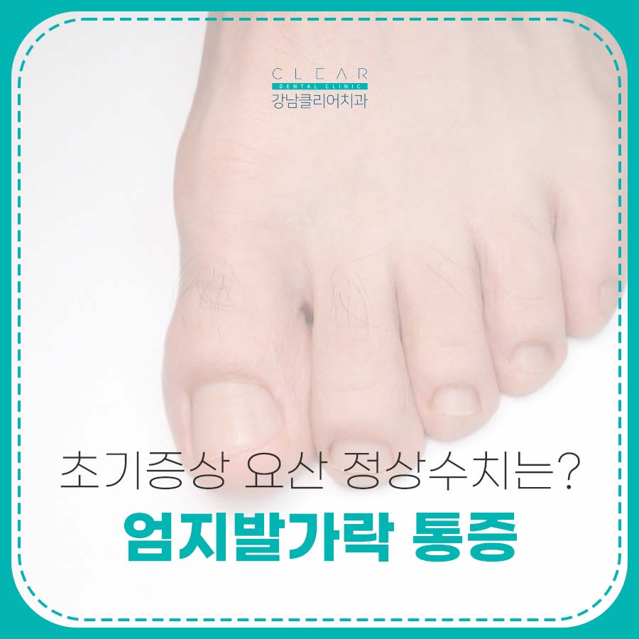 엄지발가락 통증 통풍 초기증상 요산 정상수치는? 관련 이미지 1