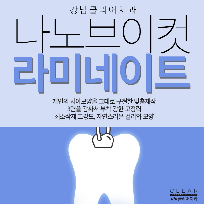 강남역라미네이트 가장 중요한 것은 관련 이미지 1