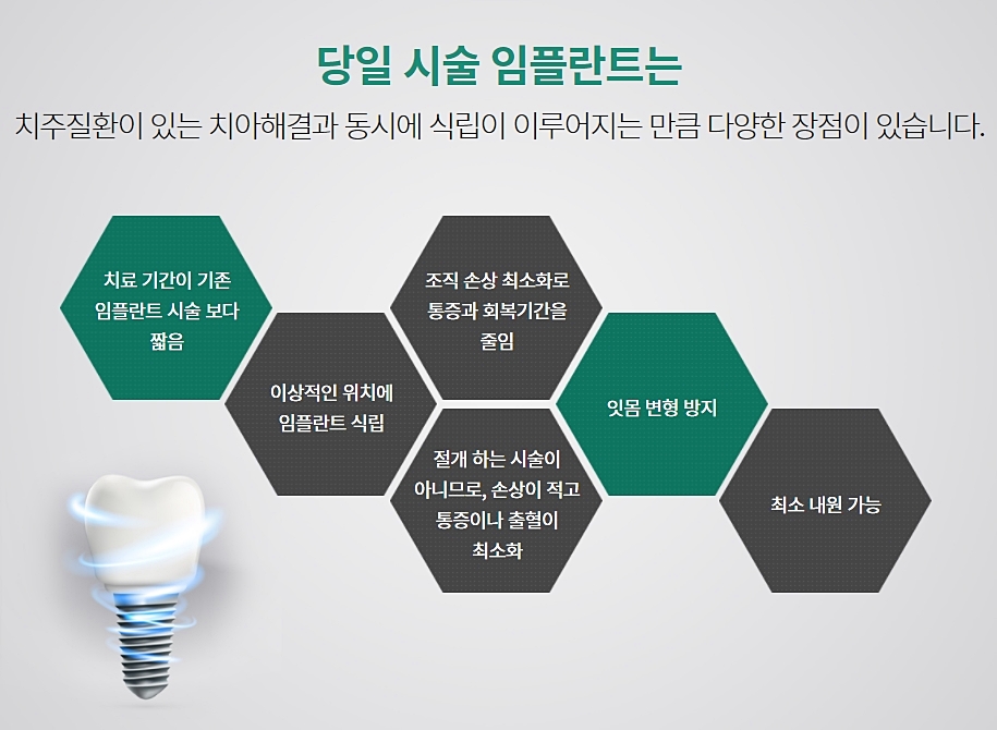 강남클리어치과 임플란트 찾고 결정 관련 이미지 7