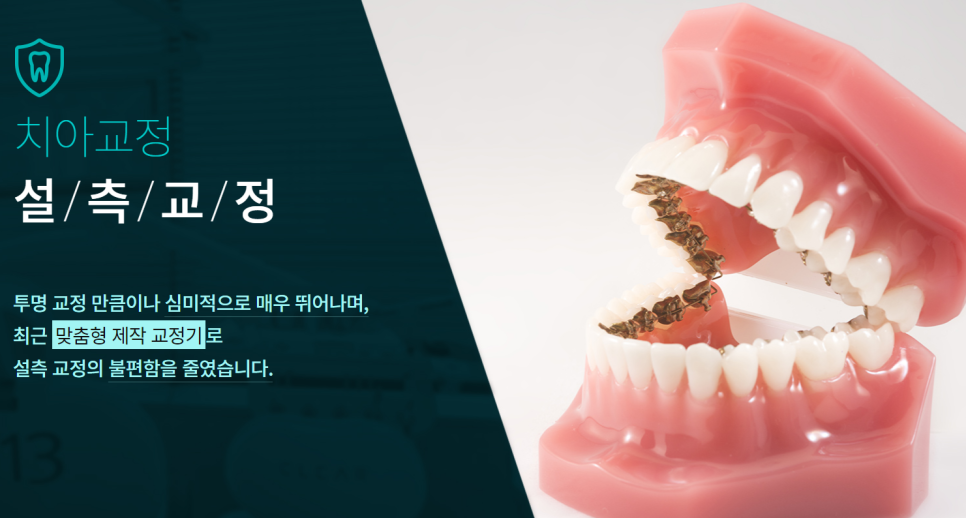 서울교정치과 심미성 좋은 클리피씨 방법으로 관련 이미지 4