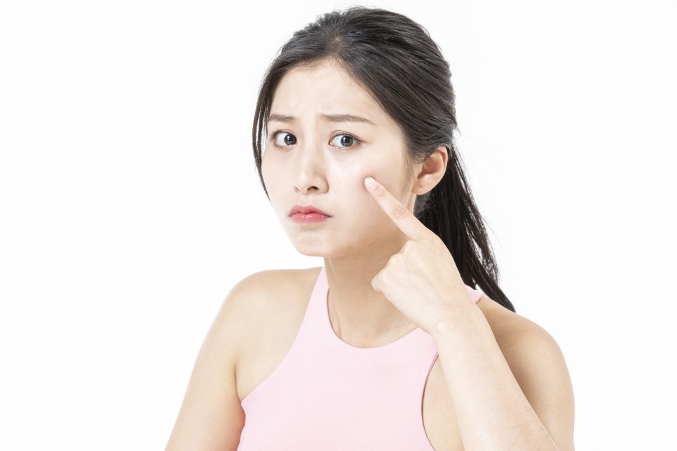 모낭염 증상 및 원인 여드름일까? 관련 이미지 3