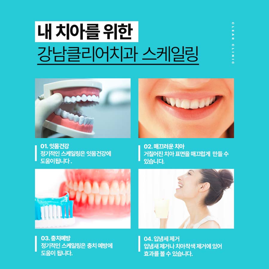 스케일링치과잘하는곳 건강한 잇몸 치아를 생각하면 관련 이미지 4