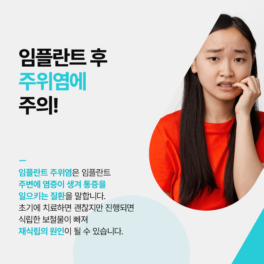 청담동 임플란트 잘하는곳 오래 사용하고 싶다면 관련 이미지 2