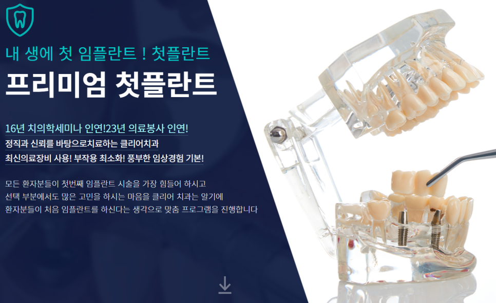 도곡동임플란트치과 불편함 없이 오래도록 사용 가능한 관련 이미지 2