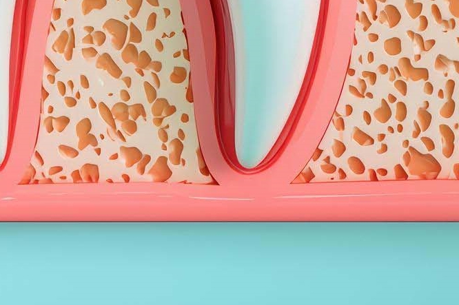 어금니 충치 통증 더 늦기 전에 시작해야 관련 이미지 32