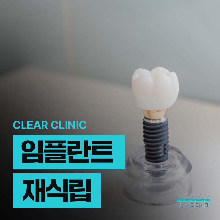 임플란트 재식립 재수술 난이도가 높은 이유 관련 이미지 1