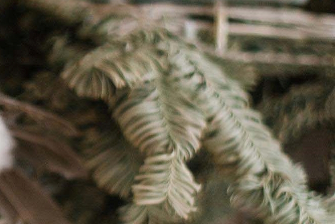 라미네이트 치아삭제 꼭 필요한 만큼만 해요 관련 이미지 29