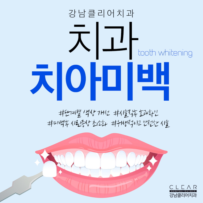 강남역치아미백 가지런만하고 누런치아? 노노! 관련 이미지 1