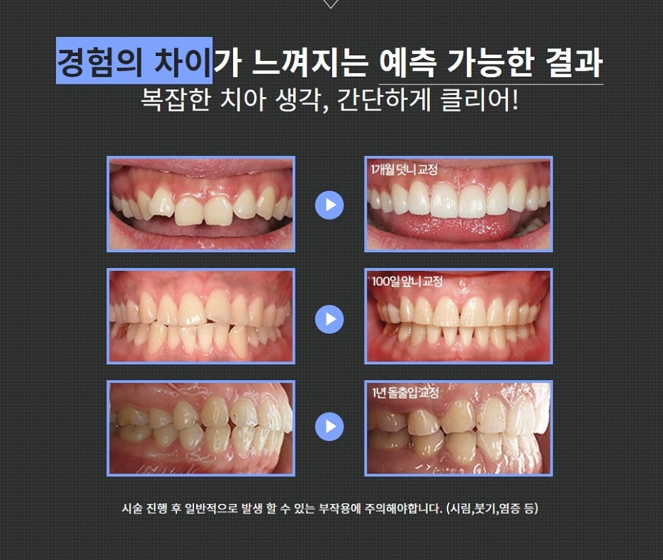 강남클리어치과 교정중점 여기와 함께라면? 관련 이미지 7