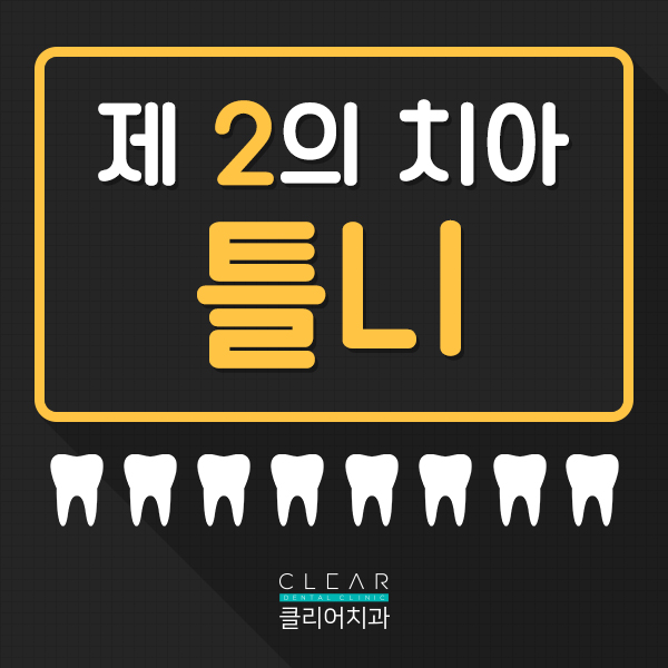제2의 치아 틀니, 틀니가 무엇인가요? 관련 이미지 1