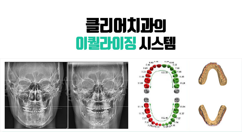 투명교정_이퀄라이징 프로그램 관련 이미지 1