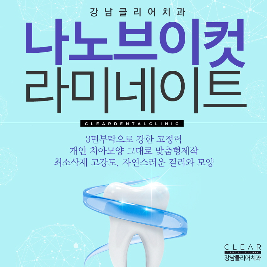 강남라미네이트 강도 고정력 유지기간 중요 관련 이미지 1