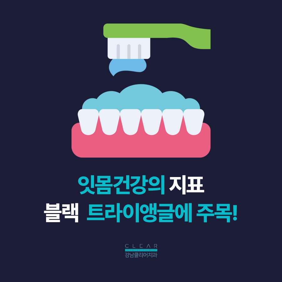 치아 블랙트라이앵글 원인 치료방법은? 관련 이미지 2