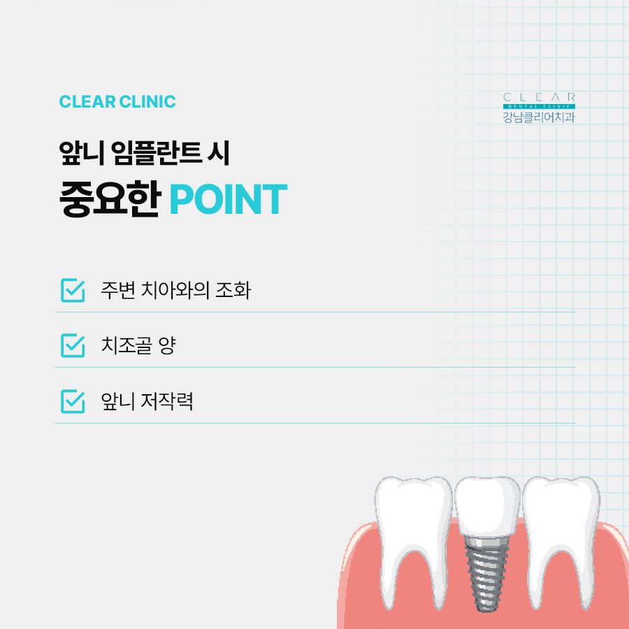 앞니 임플란트 치료기간 얼마나 걸릴까 관련 이미지 3