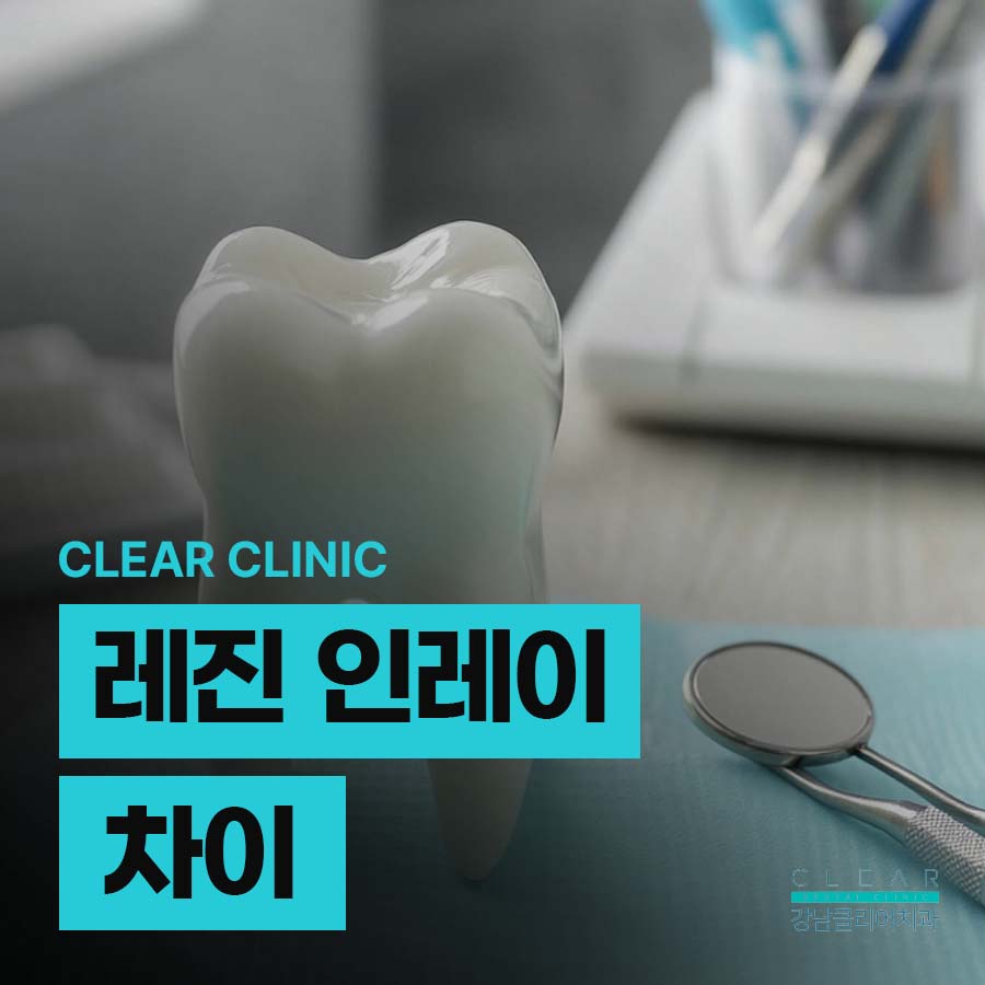 레진 인레이 차이 장단점 비교해보자 관련 이미지 1