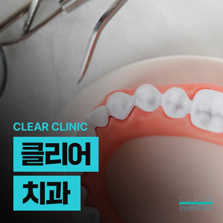 클리어치과 충치치료 단계에 따라 관련 이미지 1