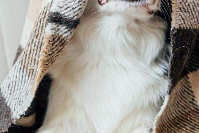 라미네이트 치아삭제 꼭 필요한 만큼만 해요 관련 이미지 19