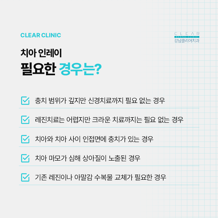 치아 인레이 이럴때 필요해요 관련 이미지 4
