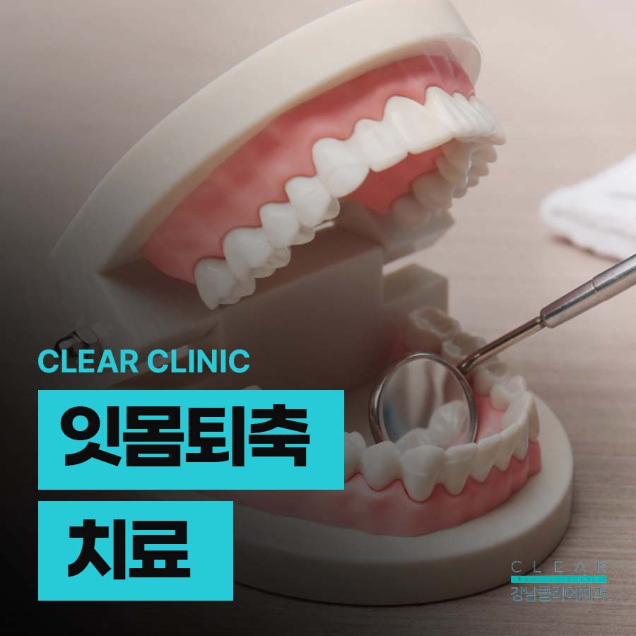 잇몸퇴축 치료 치실과 치간칫솔 사용법 중요해 관련 이미지 1