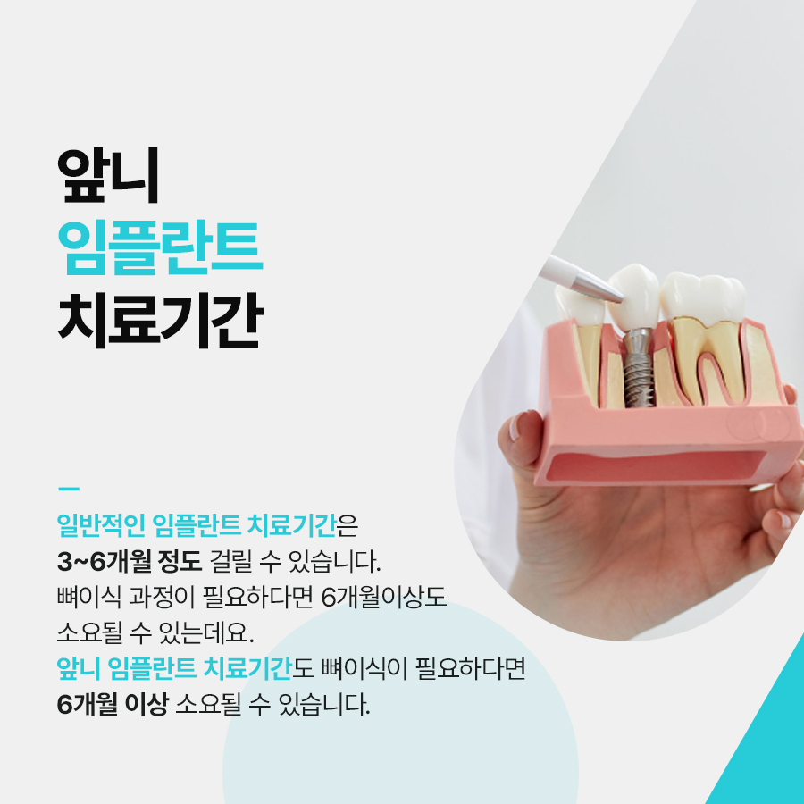 앞니 임플란트 치료기간 얼마나 걸릴까 관련 이미지 2