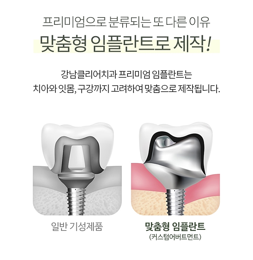 강남 치과에서 프리미엄임플란트 원한다면? 관련 이미지 4