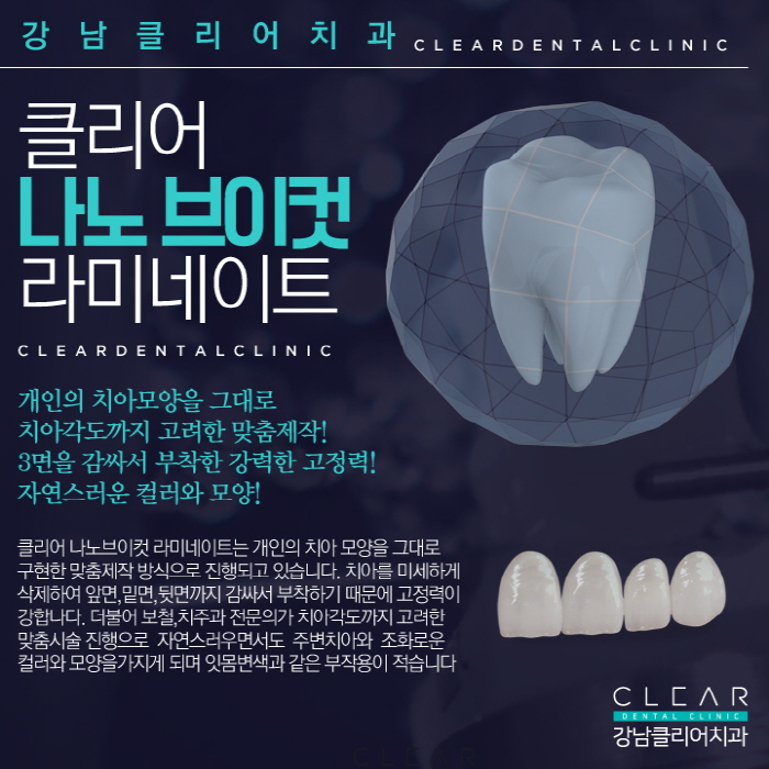 강남라미네이트 강력한 고정력 원하는 대로 맞춤디자인 관련 이미지 3