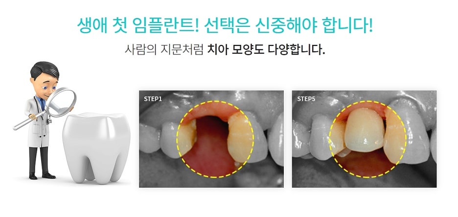 강남역 임플란트치과 소중함을 알고 관련 이미지 5