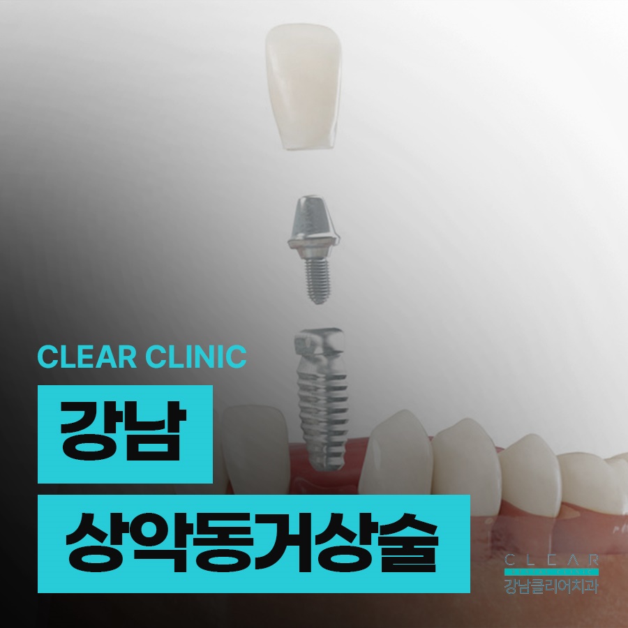 강남 상악동거상술 정밀 진단이 우선되어야 관련 이미지 1