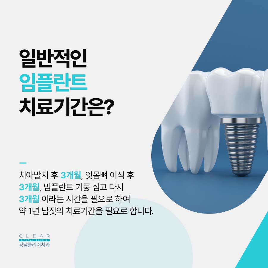 삼성동 임플란트 당일 식립이 가능한 경우는 관련 이미지 2