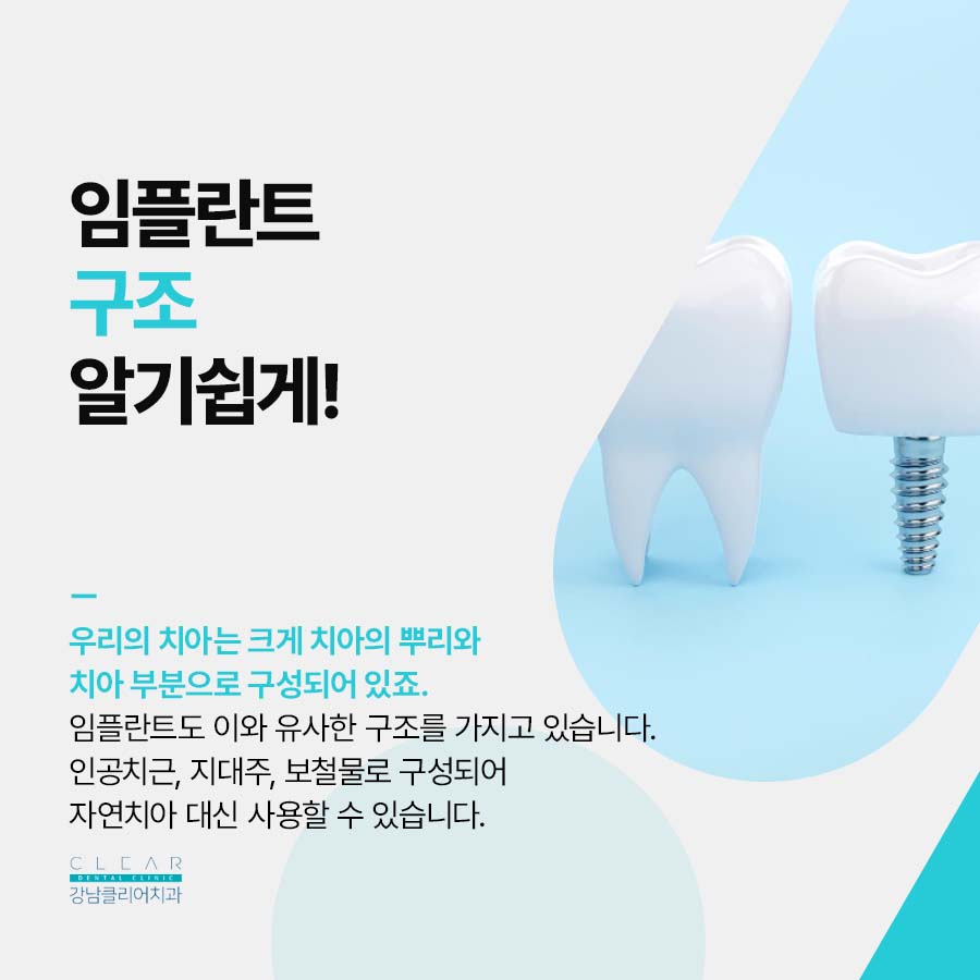 신논현 임플란트 구조 수술과정 총정리 관련 이미지 2