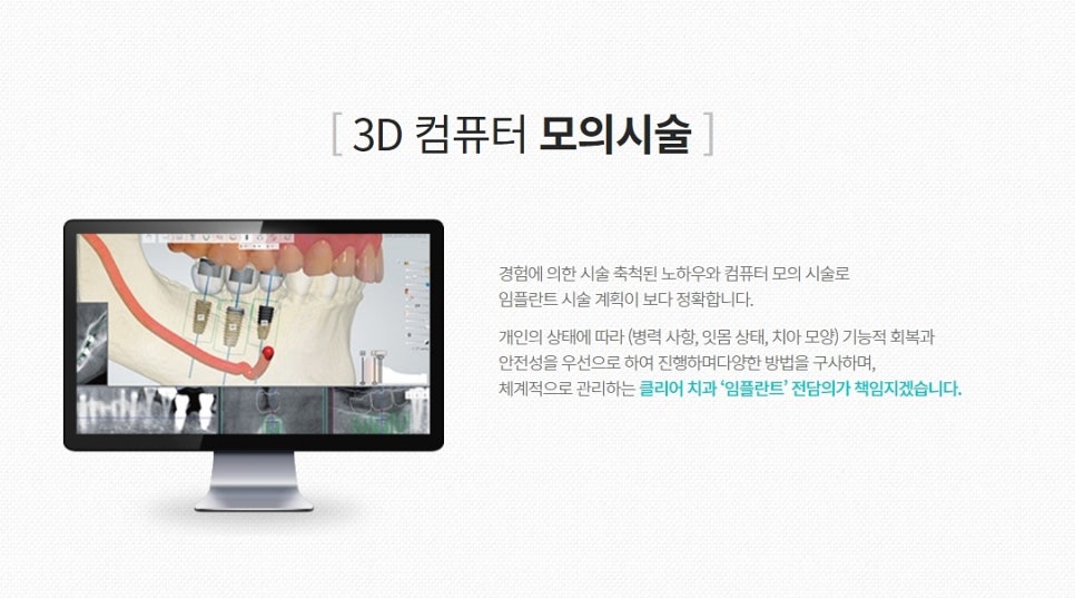 강남임플란트 찾아보고 결정하자 관련 이미지 6