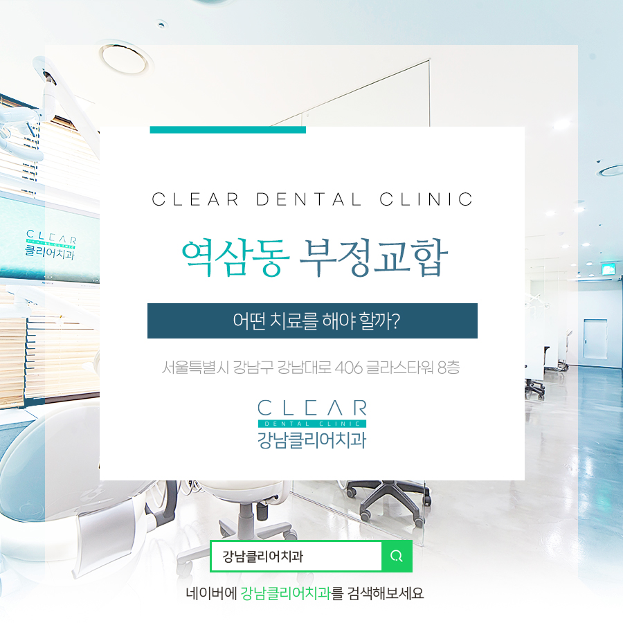 역삼동 부정교합 어떤 치료를 해야 할까? 관련 이미지 1