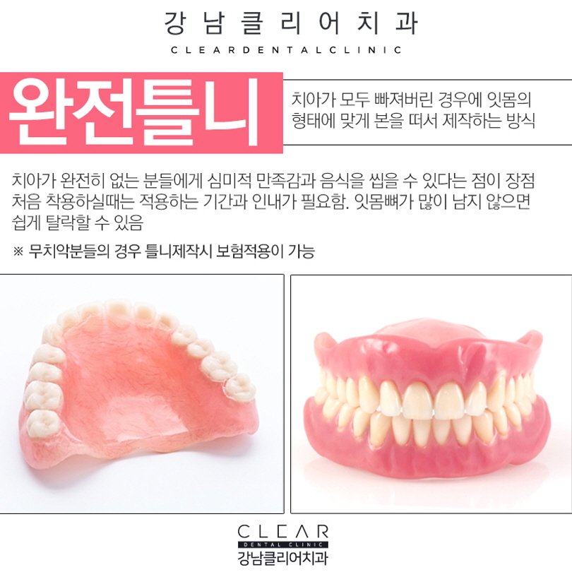 노인 틀니 임플란트틀니 가격 부담줄이기 관련 이미지 3